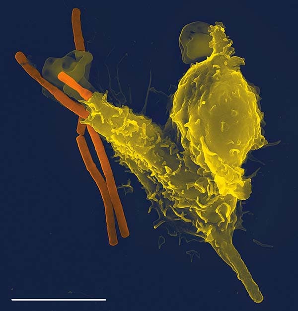 Microscope image of a white blood cell engulfing bacteria